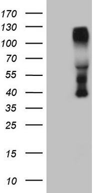 Lymphocyte Activation Gene 3 Antibody