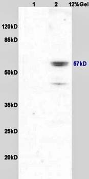 Lyn (phospho-Tyr507) antibody
