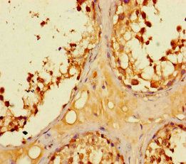 LYPD2 Antibody