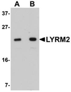 LYRM2 Antibody