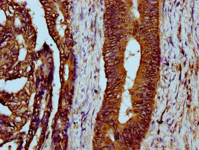 LYRM4 Antibody