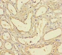 Lys-63-specific deubiquitinase BRCC36 antibody