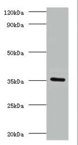 Lys-63-specific deubiquitinase BRCC36 antibody