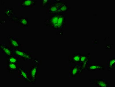 Lysine-specific demethylase 5A antibody