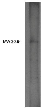 Rabbit Human Lysophosphatidic Acid Acetyltransferse beta Antibody