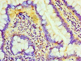 LIPA Antibody