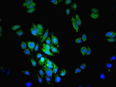 Lysosomal acid lipase/cholesteryl ester hydrolase antibody