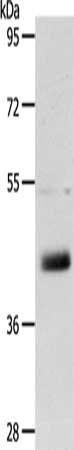 LYVE1 antibody