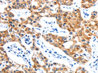 LYVE1 Antibody