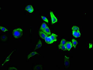 LYVE1 antibody