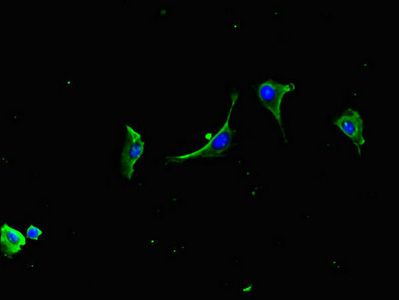LZTFL1 Antibody