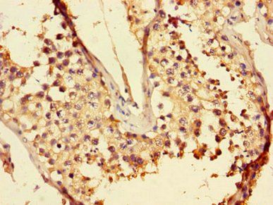 LZTFL1 Antibody