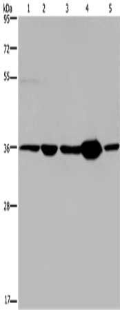 LZTFL1 Antibody