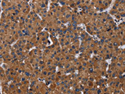 LZTFL1 antibody