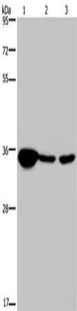 LZTFL1 Antibody