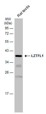 LZTFL1 antibody