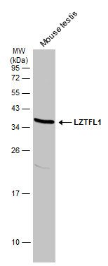 LZTFL1 antibody