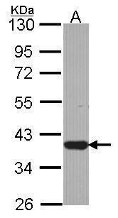 LZTFL1 antibody [N1C3]
