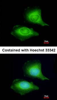 LZTFL1 antibody