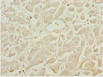 LZTR1 antibody