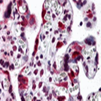 LZTS2 Rabbit Polyclonal Antibody