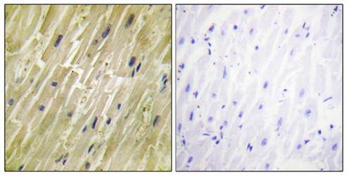 M-CK Antibody