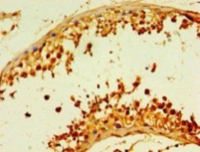 m7GpppN-mRNA hydrolase antibody