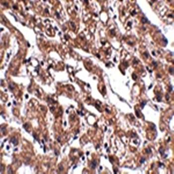 MACC1 Rabbit Polyclonal Antibody