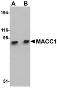 MACC1 Rabbit Polyclonal Antibody