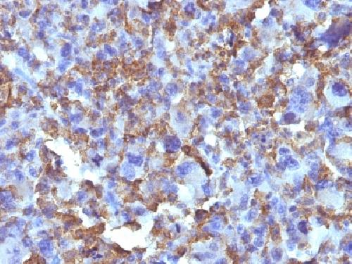 Macrophage & Histiocytoma Marker antibody