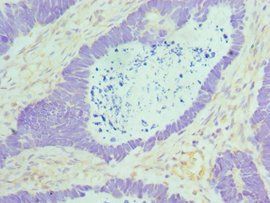 MAD2L1 Antibody