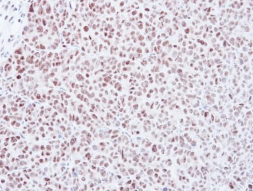 MAD2L1 antibody [C2C3], C-term
