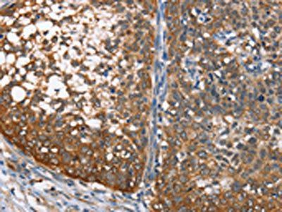 MAD2L1BP antibody