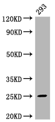 MAD2L2 Recombinant Monoclonal Antibody