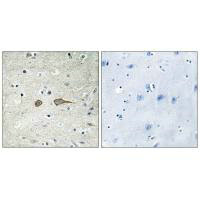 MADD Antibody