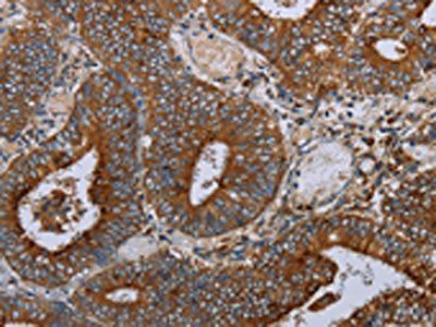 MAFF Antibody