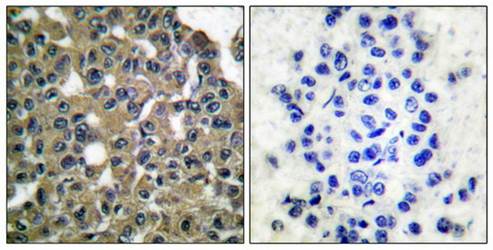 MAGE-1 Antibody