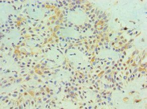 MAGEA1 antibody