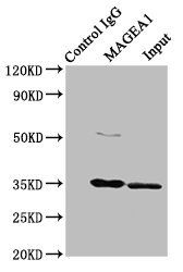 MAGEA1 antibody