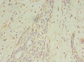 MAGEA10 Antibody
