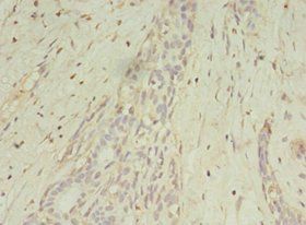 MAGEA10 antibody