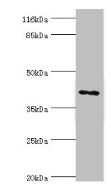 MAGEA10 Antibody