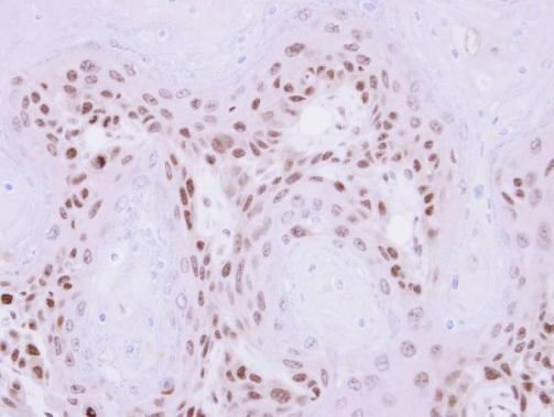 MAGEA11 antibody [N2N3]