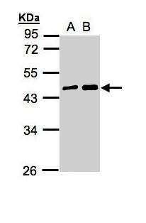 MAGEA11 antibody [N2N3]