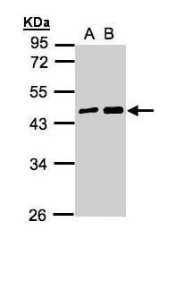 MAGEA11 antibody