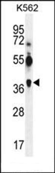 MAGEA12 antibody
