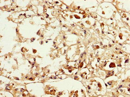 MAGEA3 Antibody