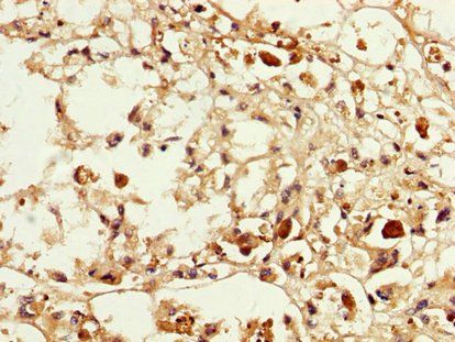 MAGEA3 antibody