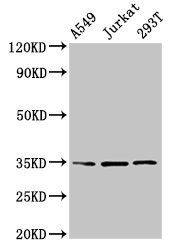 MAGEA3 antibody