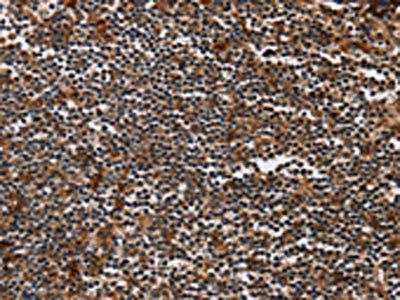 MAGEA3 Antibody
